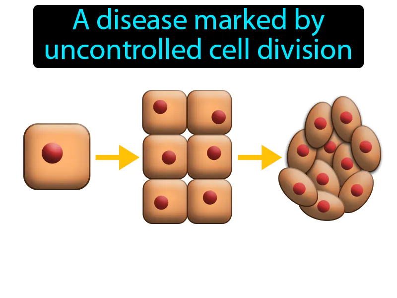 Cancer Definition Cancer Definition