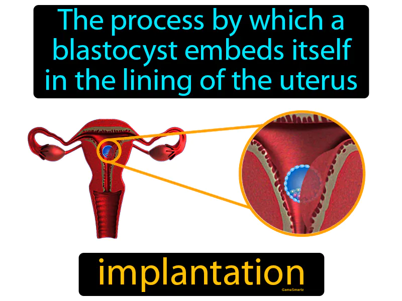 Implantation Definition Implantation Definition